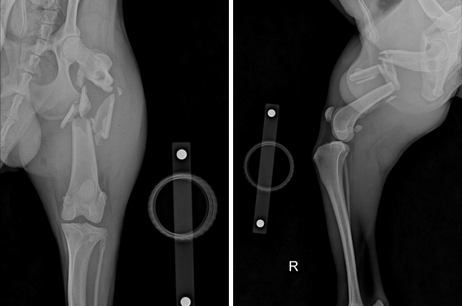 골절된 대퇴골 수술전 X-ray 사진
