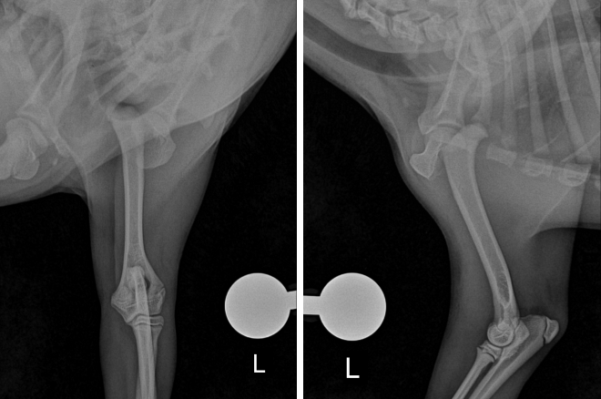 골절된 상완골 수술전 X-ray 사진