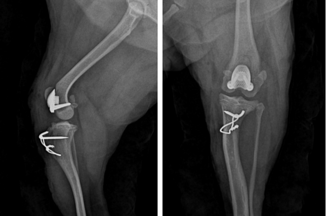 인공활차구(PGR) 수술후 X-ray 사진