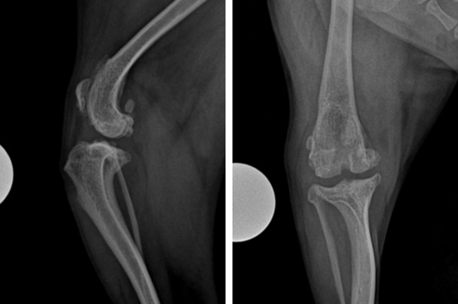 십자인대 파열 및 슬개골 탈구 수술전 X-ray 사진