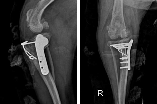 TPLO + TTT 수술후 X-ray 사진