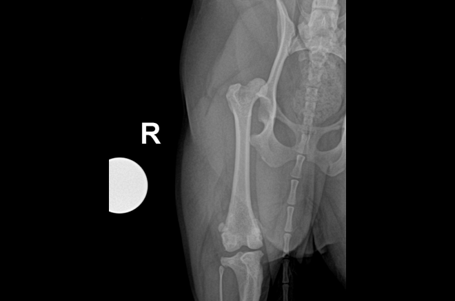 고관절 이형성증에 의한 고관절탈구 수술(FHNO)전 X-ray 사진