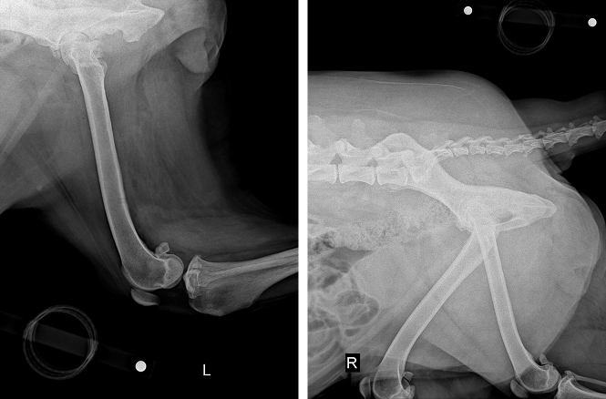 THR 수술전 X-ray 사진2